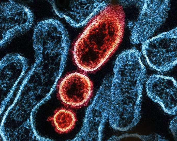 Controale riguroase în aeroporturile asiatice după comunicatul Indiei referitor la noi cazuri de infecție cu virusul Nipah