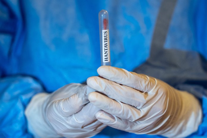 Femeia internată în Alicante din cauza bănuielii de hantavirus a obținut un rezultat negativ la testul PCR. Ce urmează?