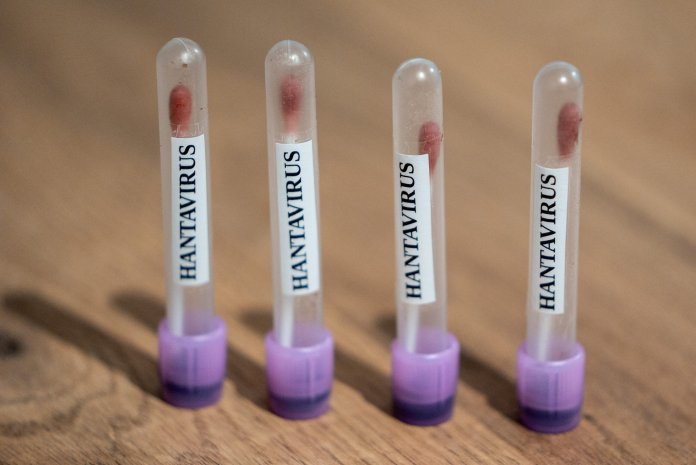 Italia declară că patru indivizi în carantină pentru hantavirus au obținut rezultate negative la analize.